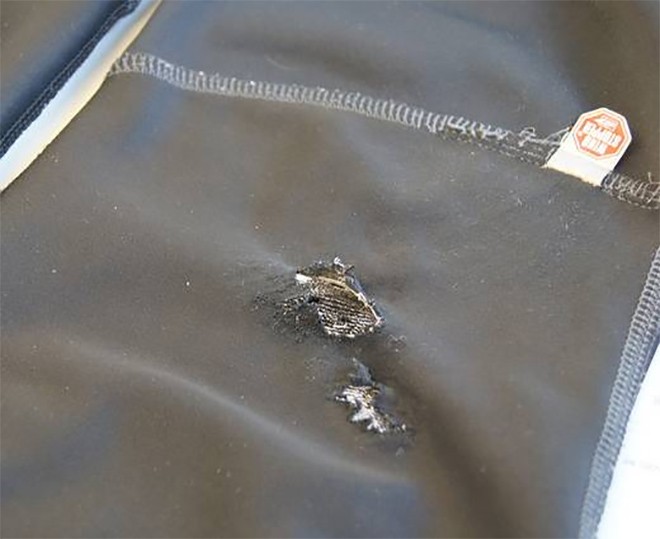 Hole in pants